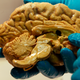 A human brain.